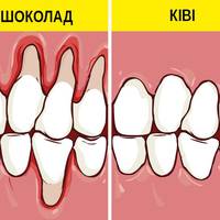 Як зберегти здоровя зубів та відбілити їх за допомогою їжі