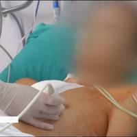 У Києві провели надскладну операцію на серці 13-річному хлопцю: як нині почувається пацієнт