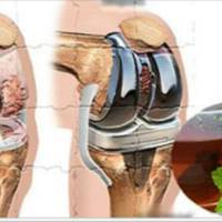 Простий засіб для відновлення хрящів колін, суглобів і зміцнення кісток! Рекомендує лікар натуропат