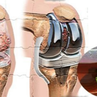 Ефективний засіб для відновлення хрящів колін, суглобів і зміцнення кісток!