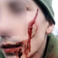 Геройський вчинок у зоні проведення ООС: солдат Герман знешкодив і затримав представника російсько-окупаційних військ