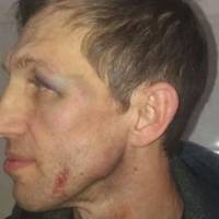 Побитий фізкультурник  розповів, чим саме викликав лють батька школяра