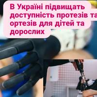 В Україні підвищать доступність протезів та ортезів для постраждалих від агресії рф: що зміниться